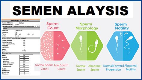 How to Read Sperm Analysis Report Results .